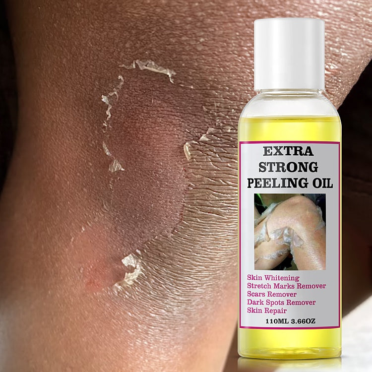 Extra Strong Peeling Oil