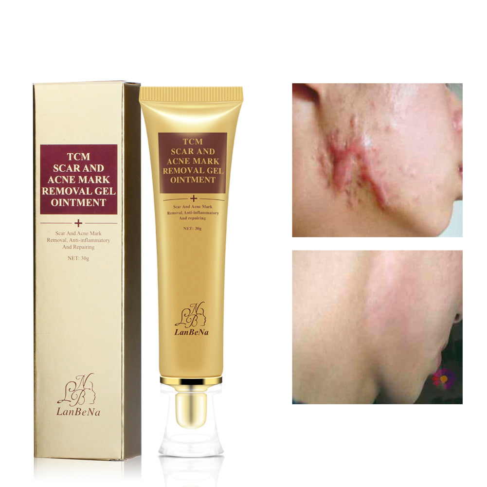 Gel LanBeNa TCM