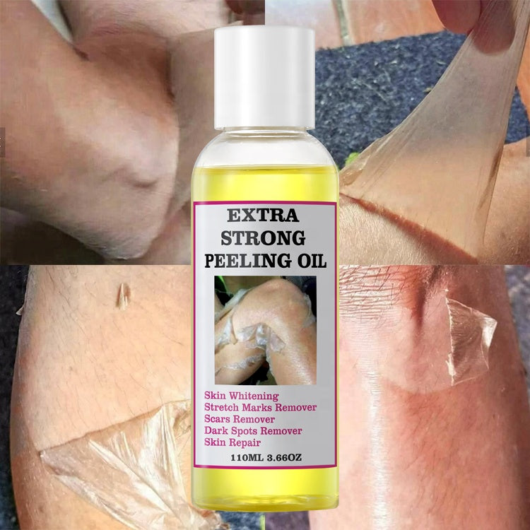 Extra Strong Peeling Oil