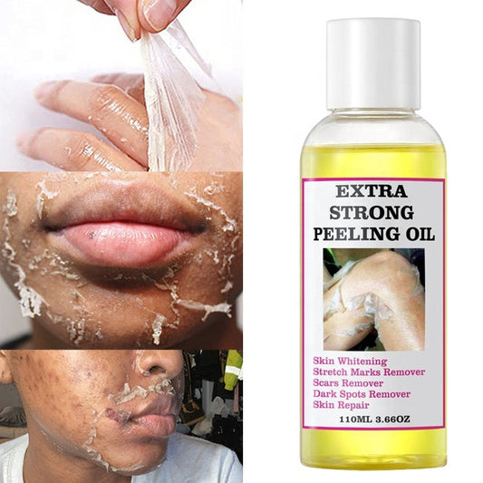 Extra Strong Peeling Oil