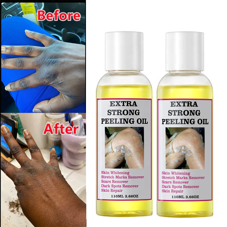 Extra Strong Peeling Oil